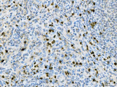 Anti-CXCR2 Antibody Boster Bio