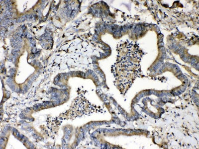 Anti-Beta 2 Microglobulin/B2M Antibody Picoband® Boster Bio