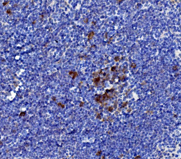 Anti-IL-21/Il21 Antibody Boster Bio