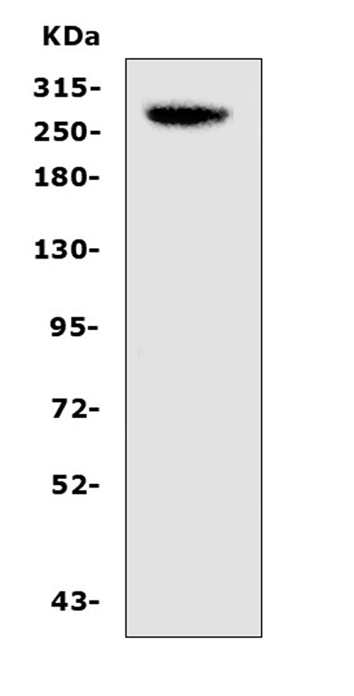 Anti-CAD/CAD Antibody Picoband® Boster Bio