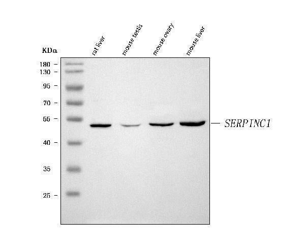 Anti-Antithrombin III/SERPINC1 Antibody Picoband® Boster Bio