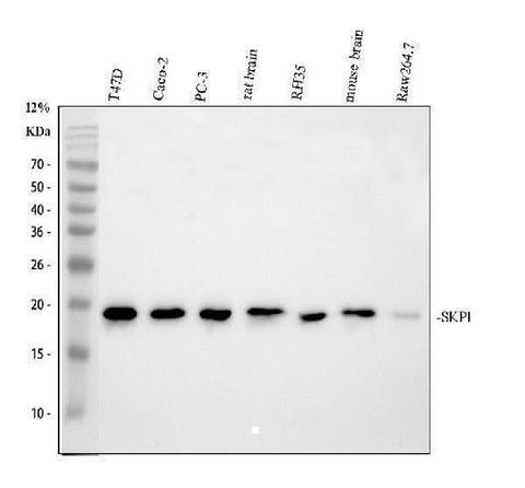 Anti-SKP1 Antibody Picoband® Boster Bio
