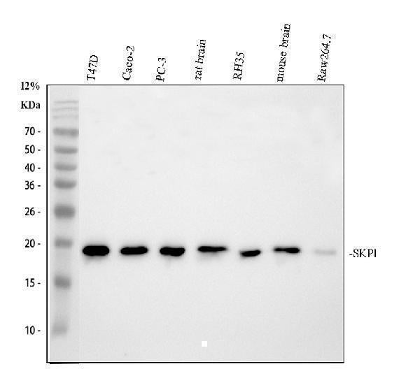 Anti-SKP1 Antibody Picoband® Boster Bio