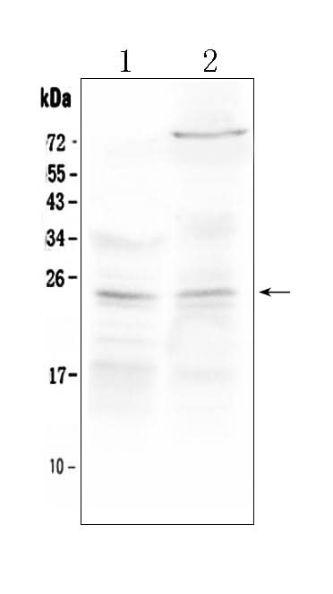Anti-TIMP3 Antibody Picoband® Boster Bio