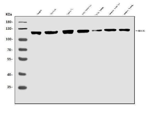 Anti-MERTK Antibody Picoband® Boster Bio