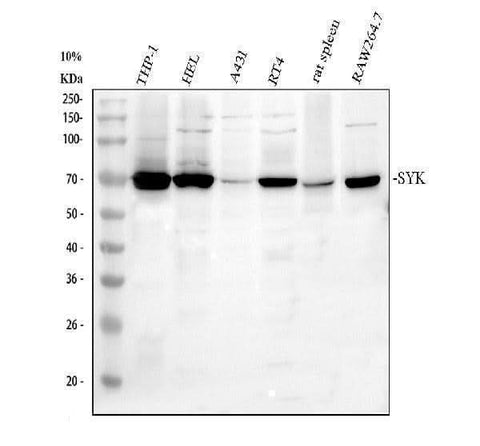 Anti-SYK Antibody Picoband® Boster Bio