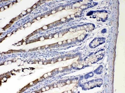 Anti-Cytochrome P450 2D6/CYP2D6 Antibody Picoband® Boster Bio