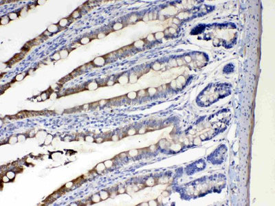 Anti-Cytochrome P450 2D6/CYP2D6 Antibody Picoband® Boster Bio