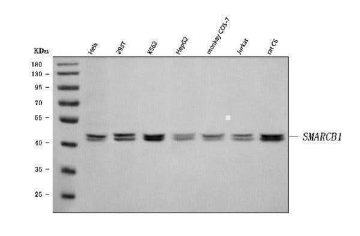 Anti-SNF5/SMARCB1 Antibody Picoband® Boster Bio