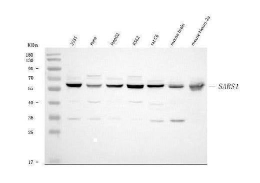 Anti-Seryl-tRNA synthetase/SERS/SARS1 Antibody Picoband® Boster Bio