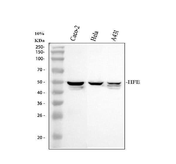 Anti-HFE Antibody Picoband® Boster Bio