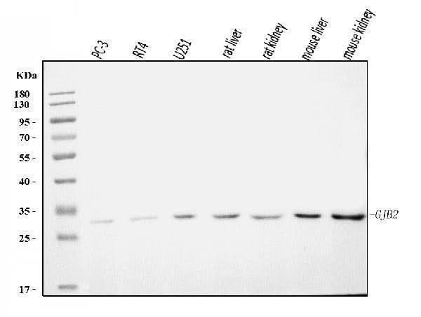 Anti-GJB2 Antibody Picoband® Boster Bio