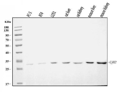 Anti-GJB2 Antibody Picoband® Boster Bio