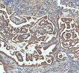 Anti-Sacsin Antibody Boster Bio