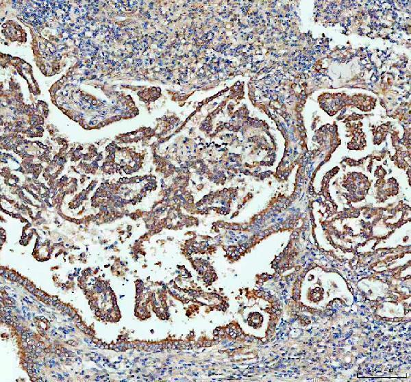 Anti-Sacsin Antibody Boster Bio