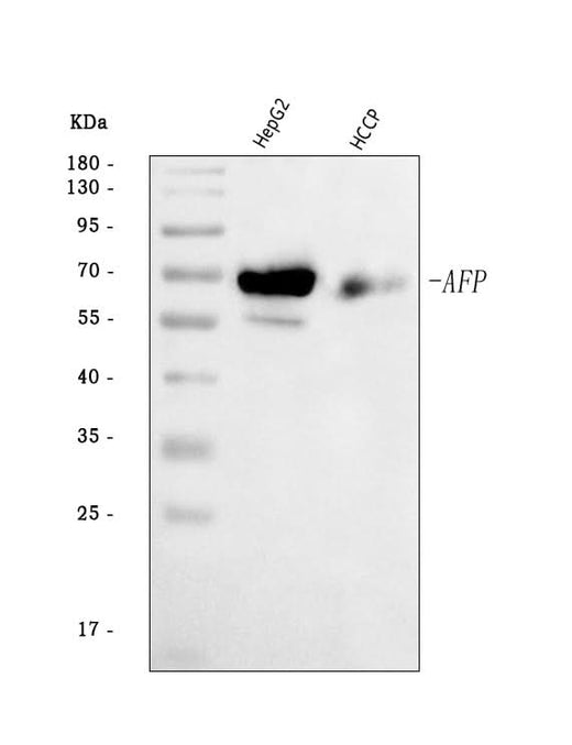 Anti-alpha 1 Fetoprotein/AFP Antibody Picoband® Boster Bio