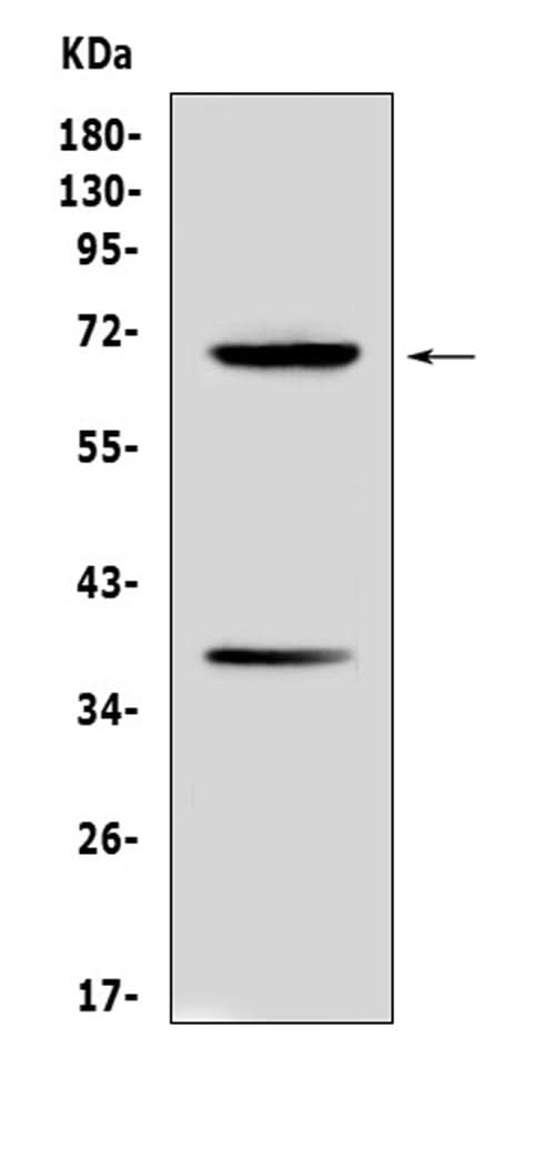 Anti-Alpha 1 Fetoprotein/Afp Antibody Picoband® Boster Bio