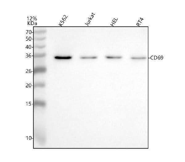 Anti-CD69 Antibody Picoband® Boster Bio