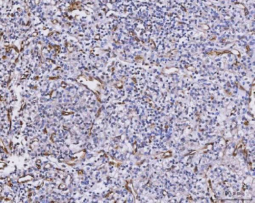 Anti-CXCL1 Antibody Boster Bio