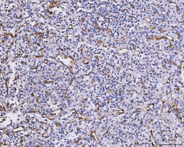 Anti-CXCL1 Antibody Boster Bio
