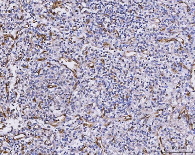 Anti-CXCL1 Antibody Boster Bio