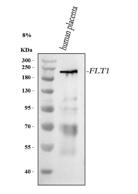 Anti-VEGFR-1/FLT1 Antibody Picoband® Boster Bio