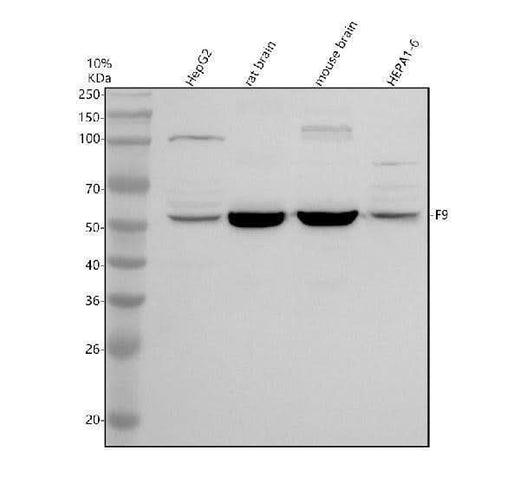Anti-Factor IX/PTC/F9 Antibody Picoband® Boster Bio