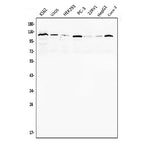Anti-Androgen Receptor/AR Antibody Picoband® Boster Bio