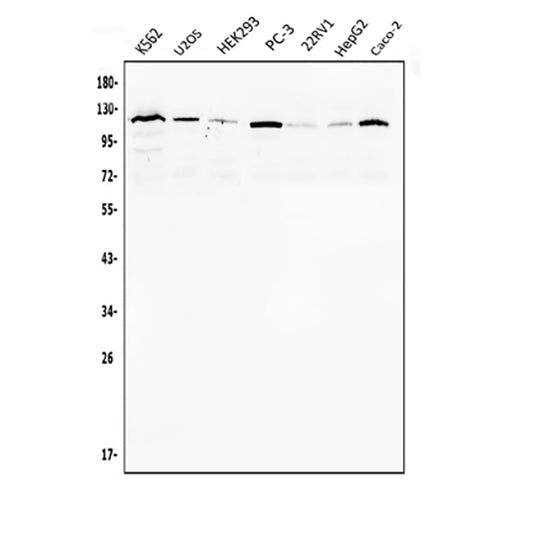 Anti-Androgen Receptor/AR Antibody Picoband® Boster Bio