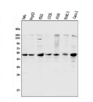 Anti-Cyclin E1/CCNE1 Antibody Picoband® Boster Bio