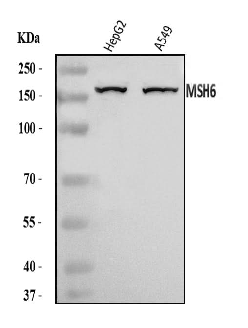 Anti-MSH6 Antibody Picoband® Boster Bio
