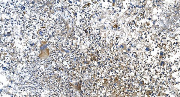 Anti-DRP1/DNM1L Antibody Picoband® Boster Bio