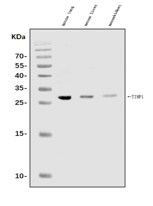 Anti-TIMP1 Antibody Picoband® Boster Bio