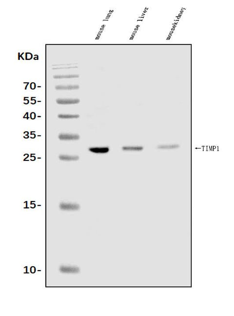 Anti-TIMP1 Antibody Picoband® Boster Bio