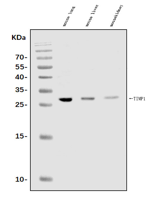 Anti-TIMP1 Antibody Picoband® Boster Bio