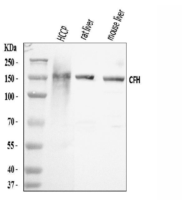 Anti-Factor H/CFH Antibody Picoband® Boster Bio
