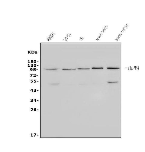 Anti-TRPV4 Antibody Picoband® Boster Bio