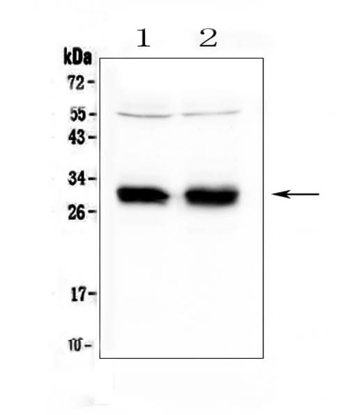Anti-HLA Class II DRB1/HLA-DRB1 Antibody Picoband® Boster Bio