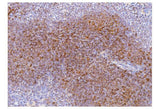 Anti-Cd2 Antibody Boster Bio