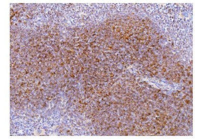 Anti-Cd2 Antibody Boster Bio