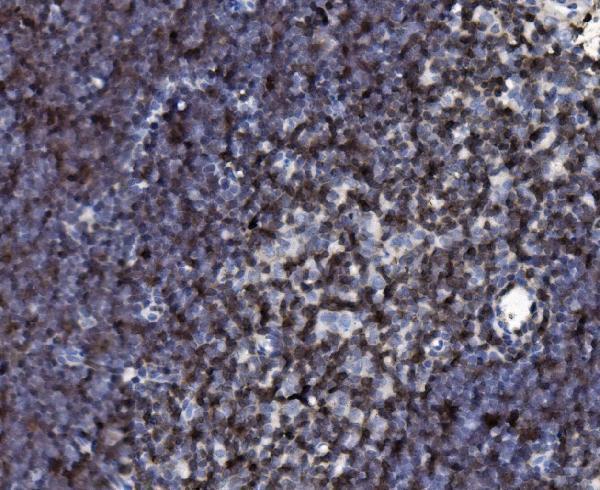 Anti-Cd2 Antibody Boster Bio