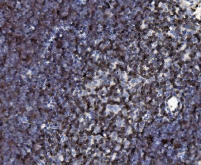 Anti-Cd2 Antibody Boster Bio
