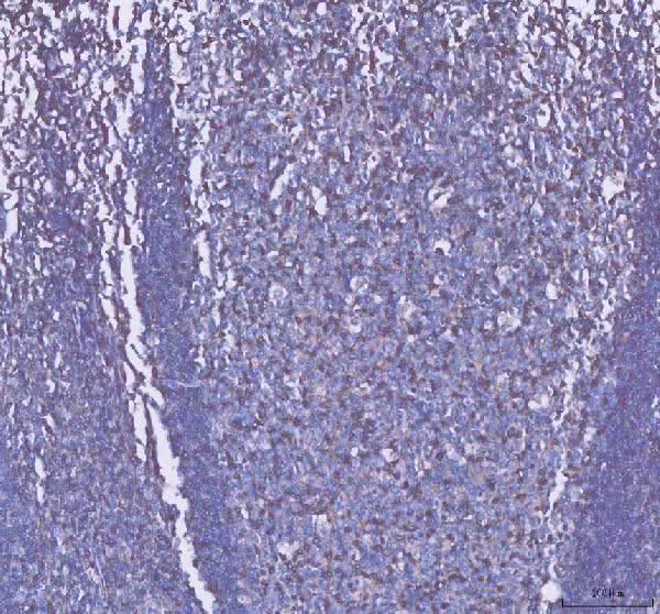 Anti-CD2 Antibody Picoband® Boster Bio