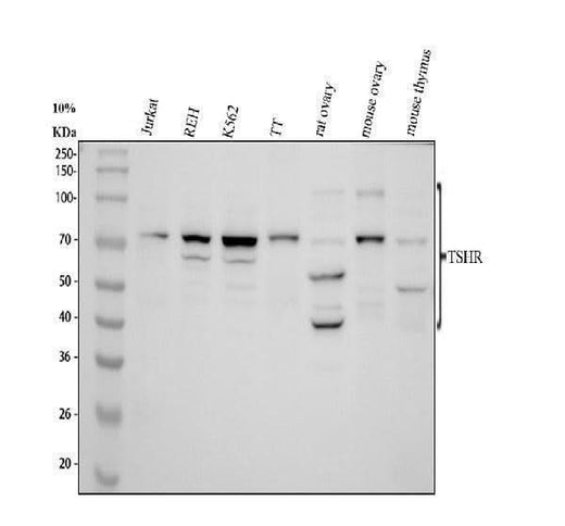 Anti-TSH Receptor/TSHR Antibody Picoband® Boster Bio