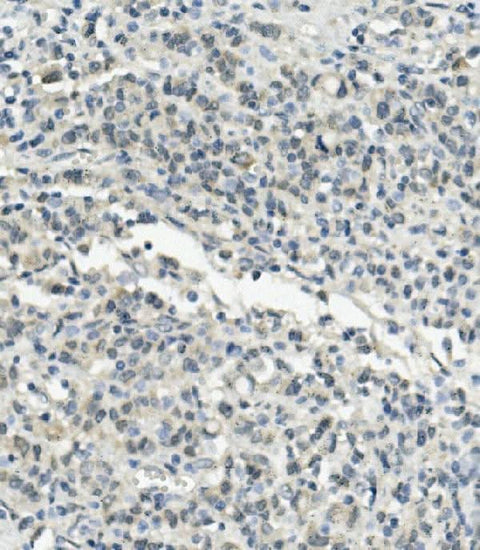 Anti-UBE3A Picoband® Antibody Boster Bio
