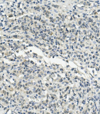 Anti-UBE3A Picoband® Antibody Boster Bio