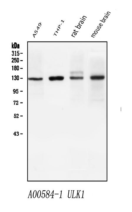 Anti-ULK1 Antibody Picoband® Boster Bio