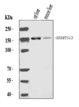 Anti-ADAMTS13 Antibody Picoband® Boster Bio