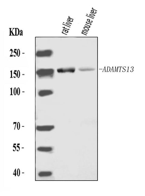 Anti-ADAMTS13 Antibody Picoband® Boster Bio