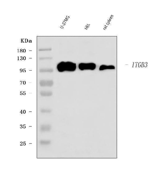 Anti-Integrin beta 3/ITGB3 Antibody Picoband® Boster Bio